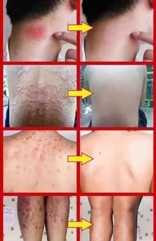 广州宸立生物制品20g净含量产品如何正确进行图文详情标注